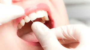 Dentist, despre riscul de a opta pentru extragerea dinților salvabili când implantul este mai rapid și mai profitabil pentru clinică