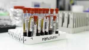 Vaccin vechi de 100 de ani, privit cu încredere de cercetătorii care studiază COVID-19. Explicaţia pentru care ar putea ajuta