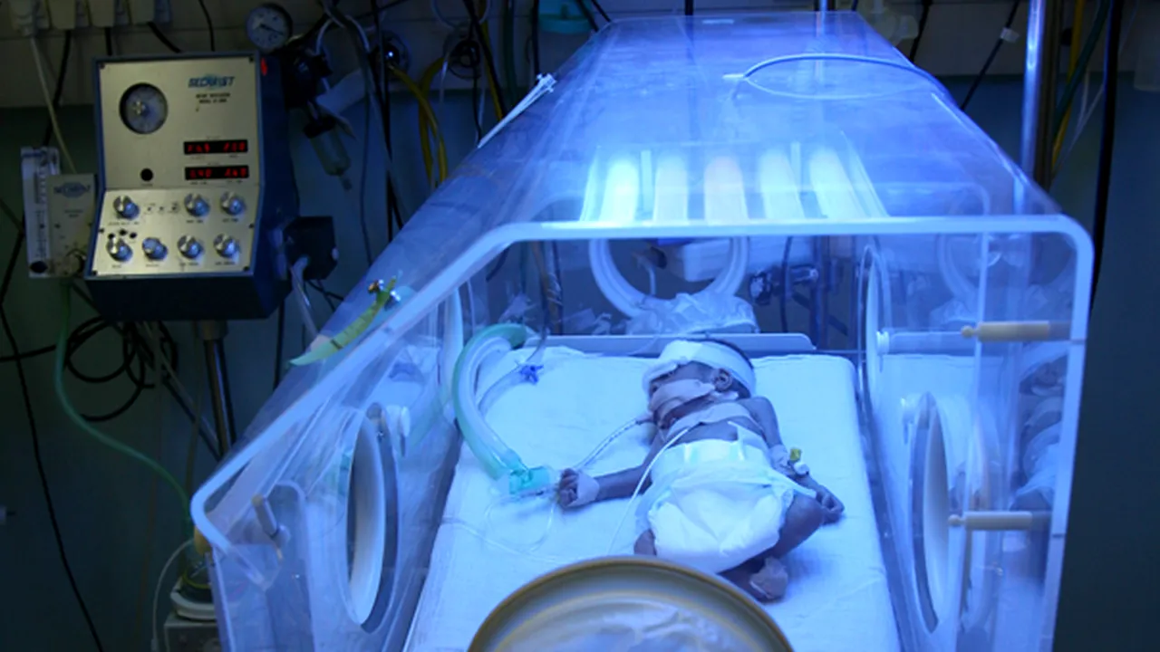 Rezultatele anchetei şi sancţiunile în cazul bebeluşului ars în incubator, anunţate luni