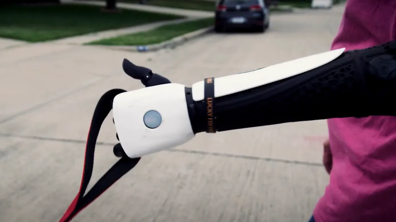Omul cu braţul bionic. Tehnologia inspirată din jocuri ce dă speranţe multor oameni