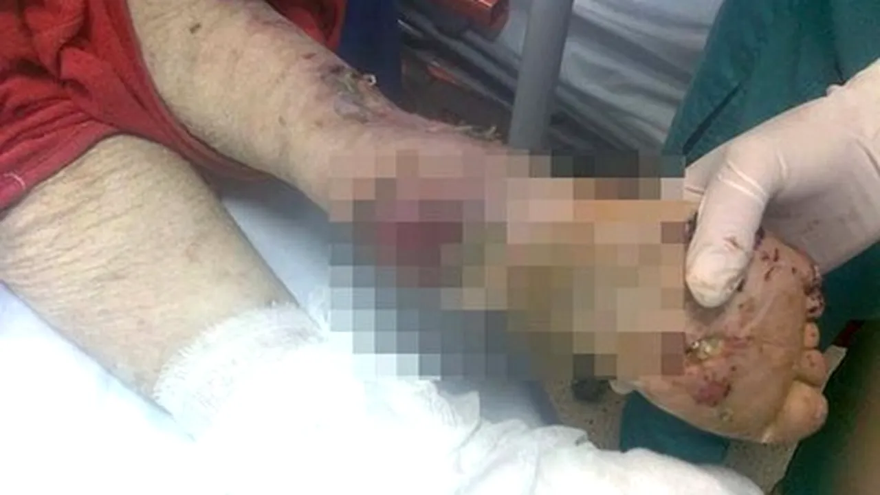 Femeia cu răni până la os, plimbată cu ambulanţa de la Constanţa la Vaslui şi retur