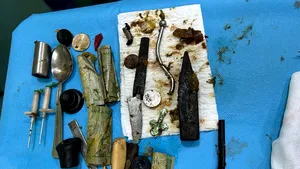 Bani, lamă de cuţit, lingură şi alte obiecte de metal, găsite în stomacul unui pacient din Iaşi