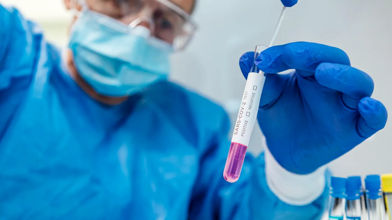 Coronavirus în România 9 august: Două judeţe fără cazuri noi de Covid-19. Bucureşti rămâne lider în topul infectărilor