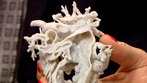 Viaţa unei fetiţe de doi ani din Marea Britanie a fost salvată mulţumită unei inimi imprimate în 3D