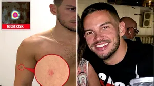 A scăpat de o formă mortală de cancer datorită unei aplicaţii a telefonului: ”Mi-a salvat viaţa”. Cum a fost posibil