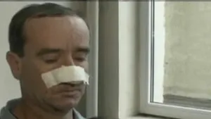 Un bărbat a ajuns la spital după ce a fost muşcat de nas - VIDEO