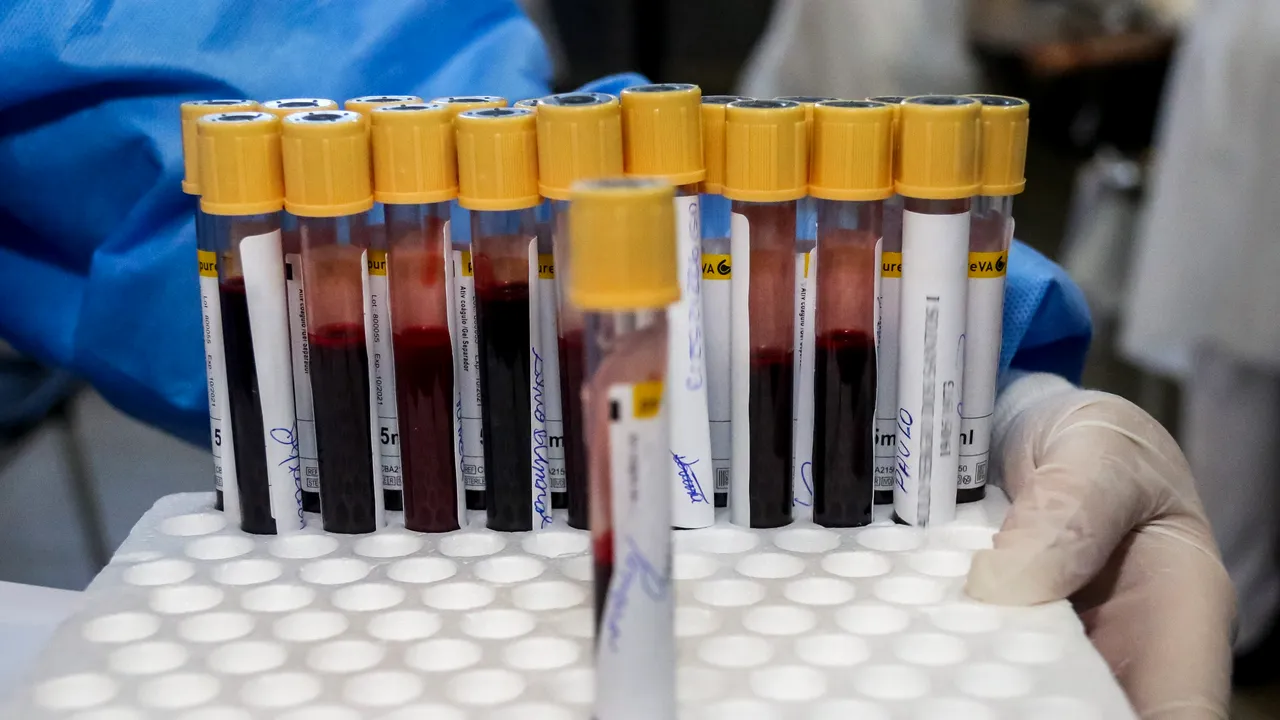 Cercetătorii spun că un nou test de sânge ar putea depista cancerul cu câţiva ani înainte ca simptomele să apară