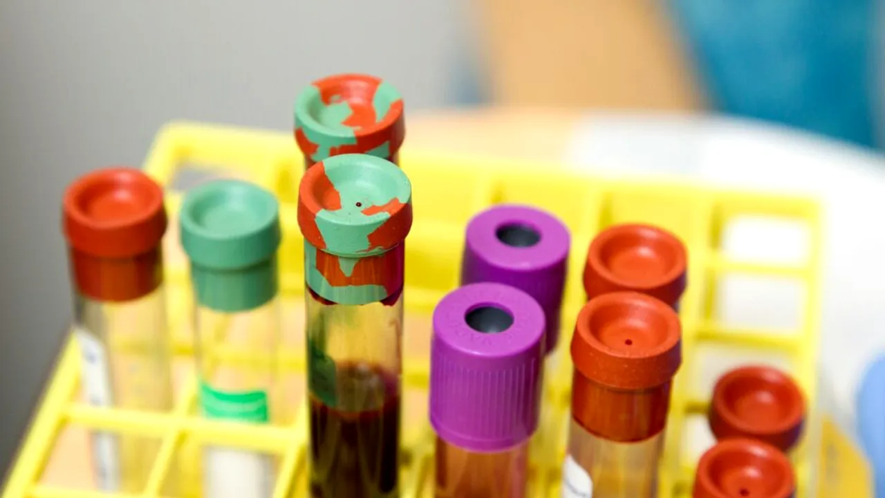 „O criză tăcută”: Infecțiile cu HIV sunt adesea depistate prea târziu în Europa