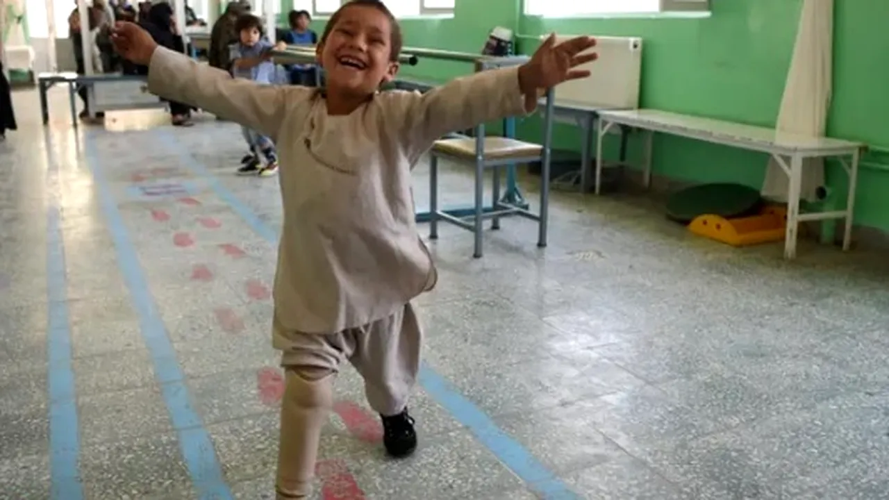 BUCURIA unui băieţel din Afganistan, la primirea unei proteze după ce i-a fost amputat piciorul. Copilul DANSEAZĂ de fericire | VIDEO 