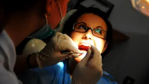 Adolescenţii merg rar la stomatolog, un copil din doi are nevoie de aparat dentar