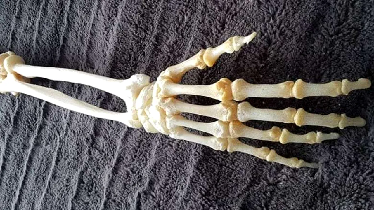 Reacţia neobişnuită a unui tânăr după ce medicii i-au spus că trebuie să îi amputeze un braţ: „Văd mereu acele decoraţiuni de Halloween şi de aici mi-a venit ideea”