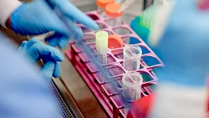 Analizele asistentului medical suspect de coronavirus. DSP Timiş anunţă că bărbatul nu are gripă