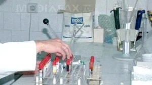 Estrogenul poate contribui la dezvoltarea cancerelor din zona capului şi gâtului