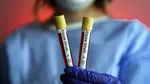 Franța confirmă primul caz de Ebola după întoarcerea unui medic din Congo