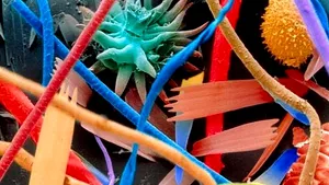 Cum arată în detaliu firele de păr, praful, sperma sau păduchii. Imagini uluitoare la microscop - GALERIE FOTO