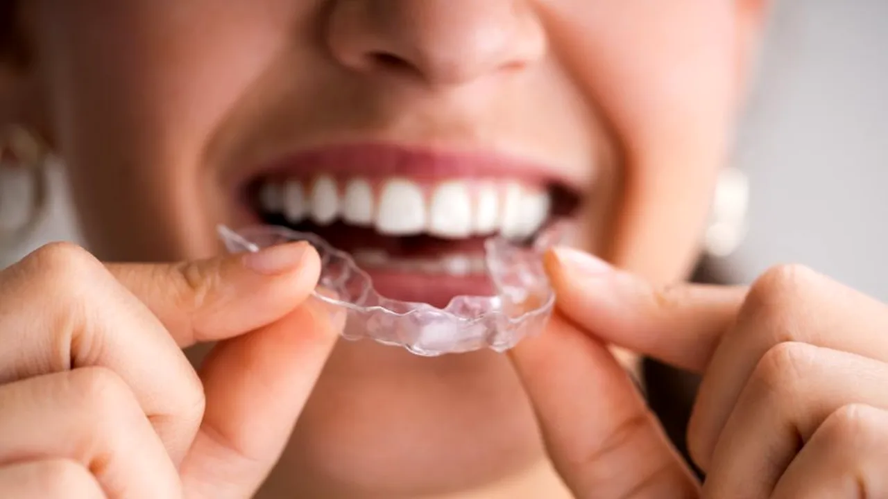 Cum poţi scăpa de bruxism, scrâşnitul dinţilor. Remediul pentru boala cu origini psihologice care îţi poate sparge dinţii