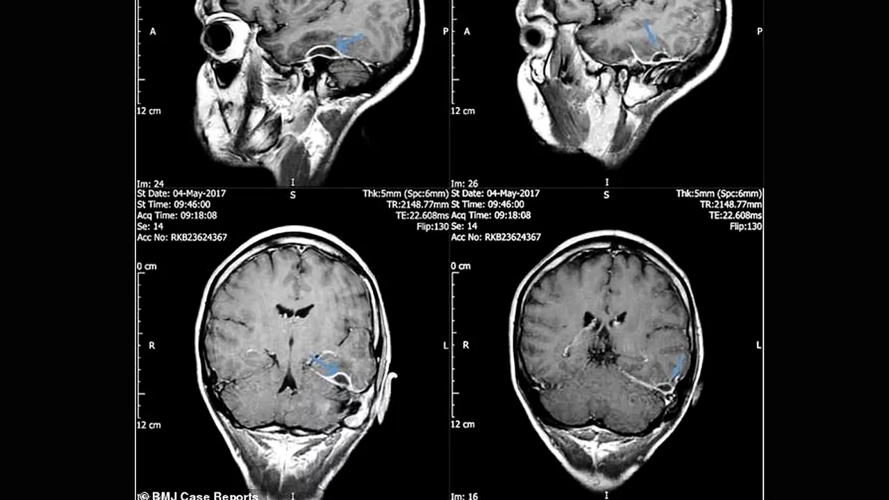 Cercetătorii au găsit o soluţie simplă pentru o memorie mai bună. Experimentul care a dus la descoperirea surprinzătoare