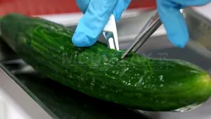 CDC: Tulpina bacteriei E.coli care a provocat 18 morţi în Europa este foarte rară