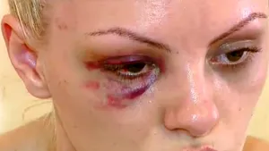 Cazul Alexandra Stan. De ce tac femeile când sunt bătute