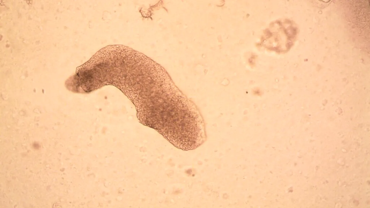 Alerta sanitară în India după creşterea numărului de cazuri de amoebă „mâncătoare de creier