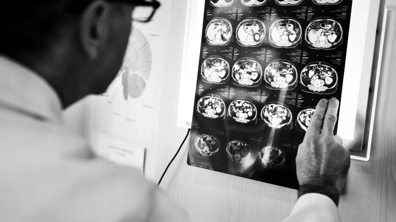 Un om de știință și-a provocat singur leziuni cerebrale cu o armă pentru a nega sindromul Havana