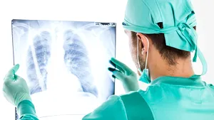 Fumătorii care preferă aceste ţigări au un risc mult mai mare de a face cancer