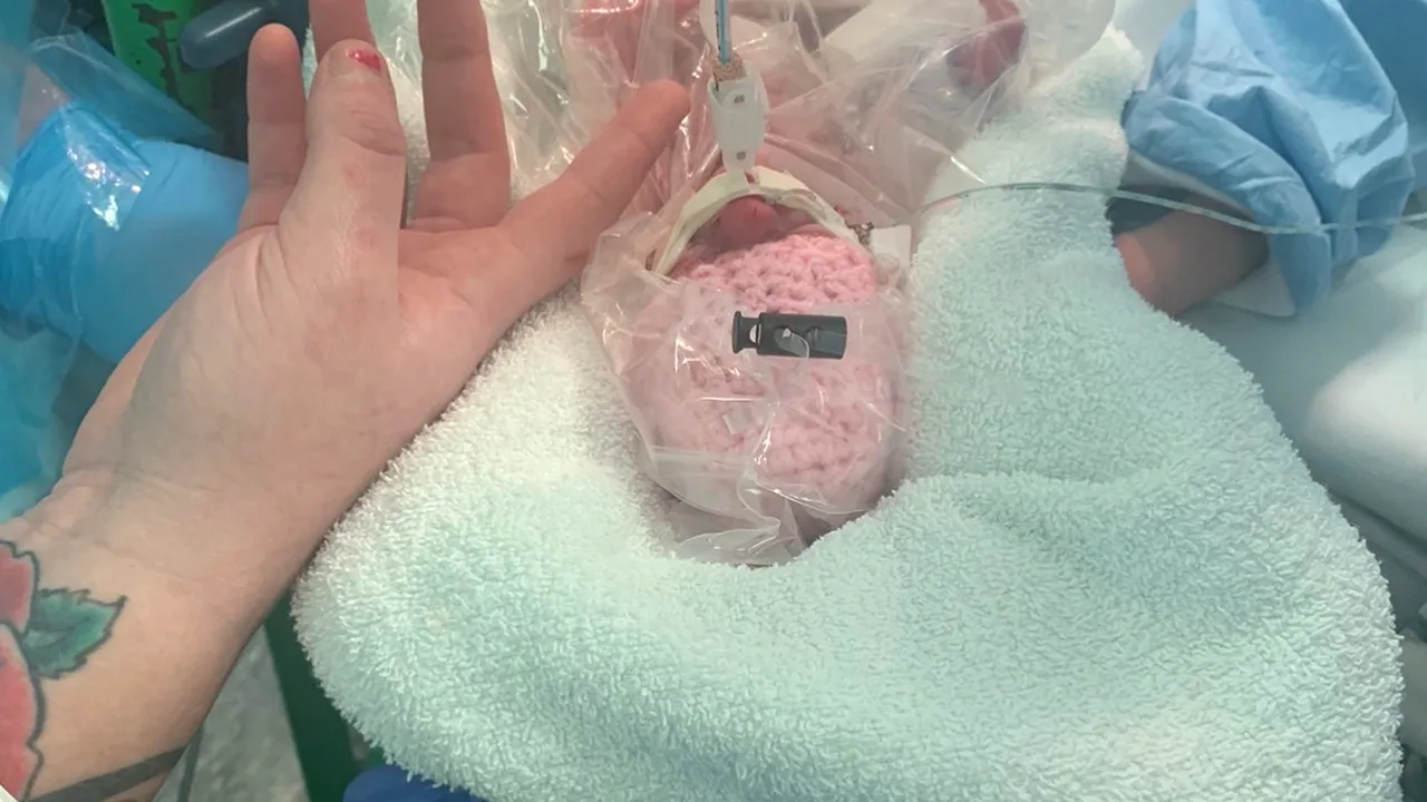 Un bebeluş prematur a supravieţuit datorită unei pungi pentru sandviş. Micuţa cântărea mai puţin de 500g