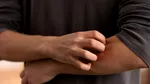 Înțepăturile de insecte: cum le recunoști, ce trebuie să faci și când trebuie să mergi de urgență la medic