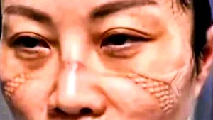 Galerie FOTO: Sacrificiul meseriei a marcat trupurile medicilor din Wuhan. Desfiguraţi din cauza echipamentului