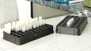 Sibiu: Poliţia cere teste ADN pentru a identifica persoana al cărei craniu a fost găsit în mlaştină