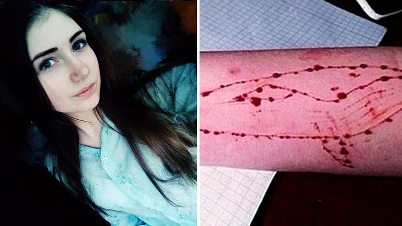 Şapte elevi din Galaţi, cu răni pe braţe. Una dintre fete a recunoscut că se juca „Balena Albastră”