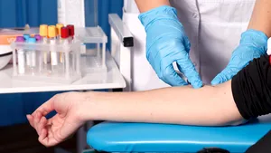 Un test de sânge „poate depista mai mult de 50 de tipuri de cancer”