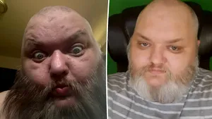 Creatorul de conținut TikTok „KingBeardX” a murit la 47 de ani