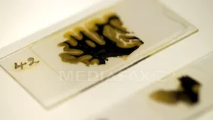 Creier uman în miniatură, obţinut în laborator: 