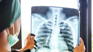 Dr. Maria Dede explică problemele respiratorii ale unui pacient vindecat de COVID-19