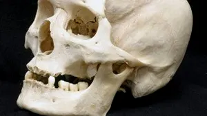 Craniu uman găsit într-un container la Satu Mare