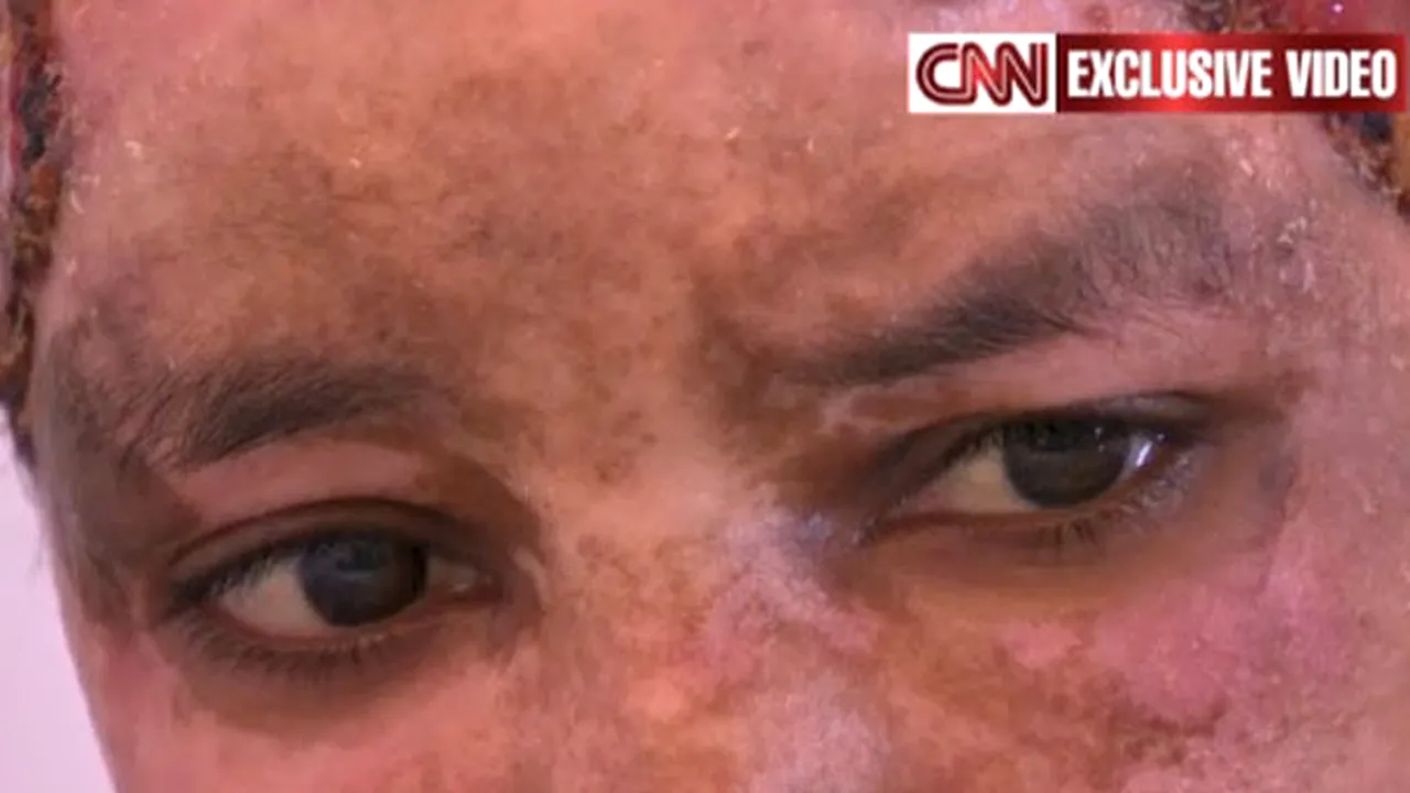 Imagini şocante: Bona copiilor unuia dintre fiii lui Kadhafi, mutilată de soţia acestuia - VIDEO