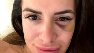 Fotbalistul acuzat că şi-a bătut partenera. Femeia s-a filmat după agresiune: „Trăiesc un coşmar cu el”