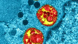 Imaginea rară a unei celule respiratorii umane infectate cu coronavirus. Cum acţionează  de fapt SARS-CoV-2