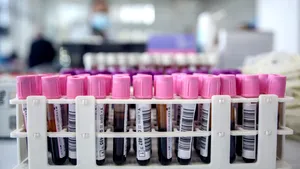 Un test de sânge ar putea detecta boala Parkinson înainte de apariția simptomelor