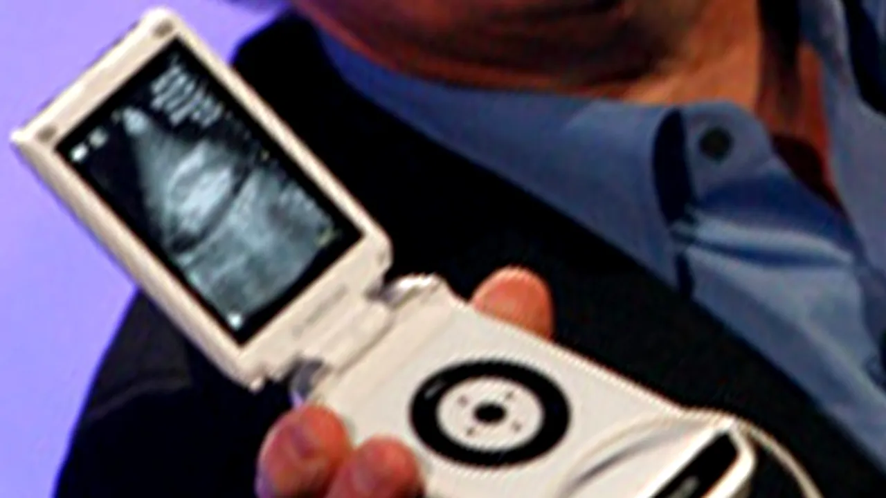 Scaner cu ultrasunete medical de dimensiunile unui telefon mobil