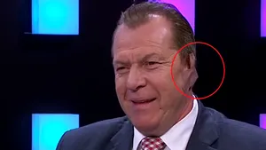 Duckadam a apărut cu urechea bandajată în direct la TV: Am spus că o tai dacă se face transferul