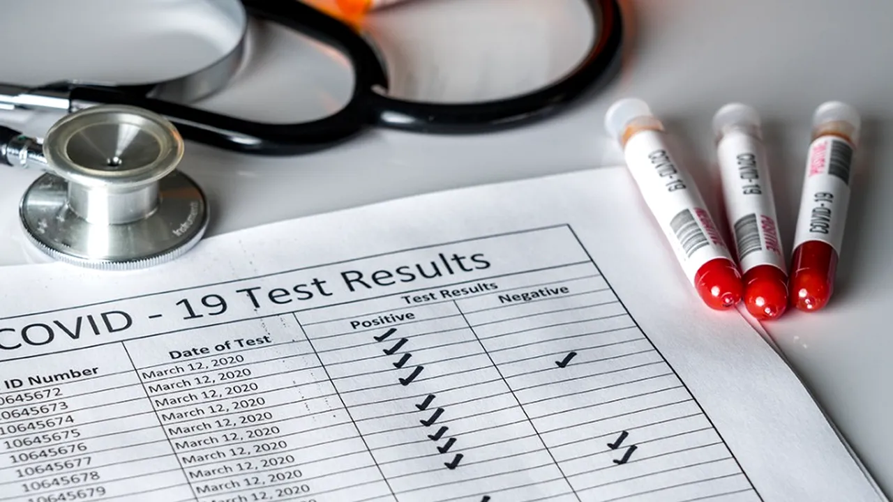 Testele pentru anticorpi SARS-CoV-2. Ce indică rezultatele testelor şi de ce diferă acestea de la un laborator la altul?