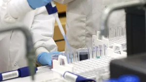 Nou test pentru depistarea tuberculozei în ţările sărace